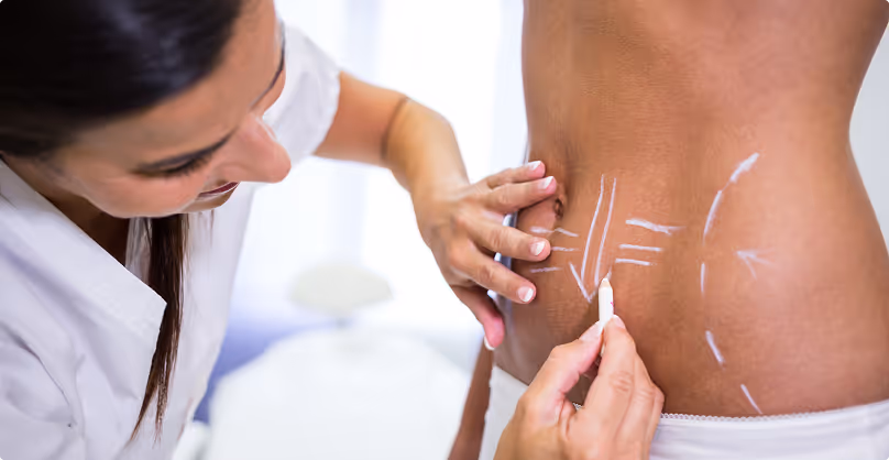 Cirurgias plásticas: Excelência e segurança